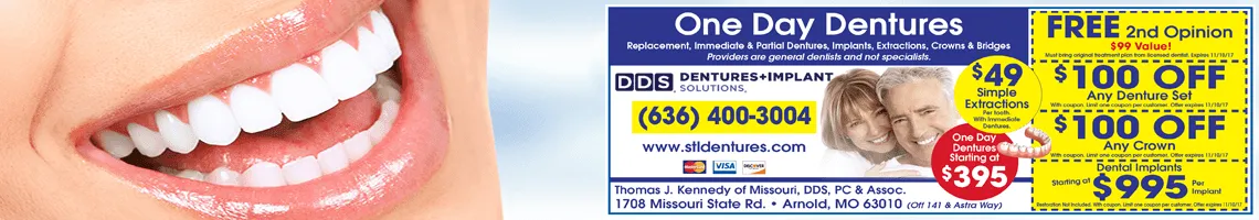 dentures cape girardeau mo